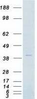 Human AURKB / Aurora-B Protein (Recombinant Myc-DDK (Flag))