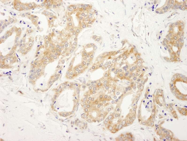 Polyclonal Rabbit anti-Human DDX6 Antibody (aa1-50, IHC)