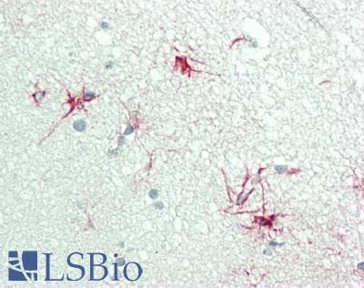 IHC-plus™ Polyclonal Rabbit anti-Human OR7C1 Antibody (170-250 aa, Internal, IHC, IF, WB)