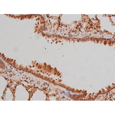 MAPT / Tau Antibody (phospho-Ser262)