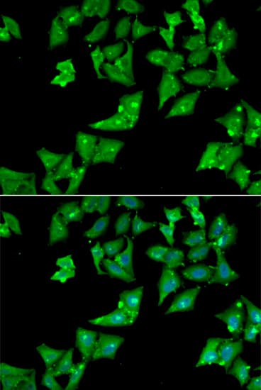 AGA / Aspartylglucosaminidase Antibody