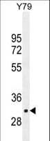 Polyclonal Rabbit anti-Human LRRC46 Antibody (aa38-67, IHC, WB)