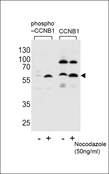 CCNB1 / Cyclin B1 Antibody (phospho-Ser35)