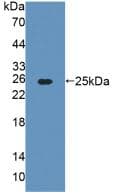 AGXT / SPT Antibody (aa182-371)