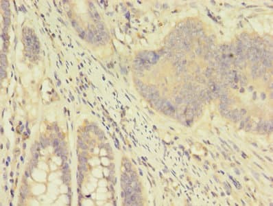 Polyclonal Rabbit anti-Human APOD / Apolipoprotein D Antibody (aa21-189, IHC)