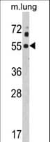 KCNJ2 / Kir2.1 Antibody (aa401-427)