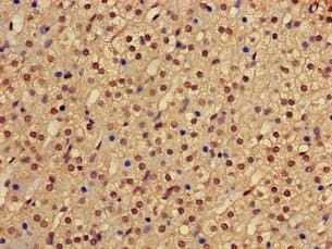 PHF21A / BHC80 Antibody