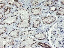 GOLM1 / GP73 / GOLPH2 Antibody (clone OTI4B12)