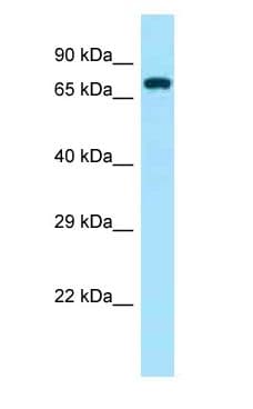 ZAP70 Antibody (aa301-350)