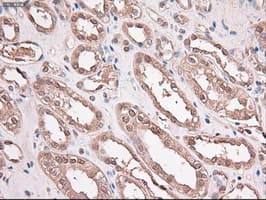 TRIM33 / TIF1-Gamma Antibody (clone OTI6B7)