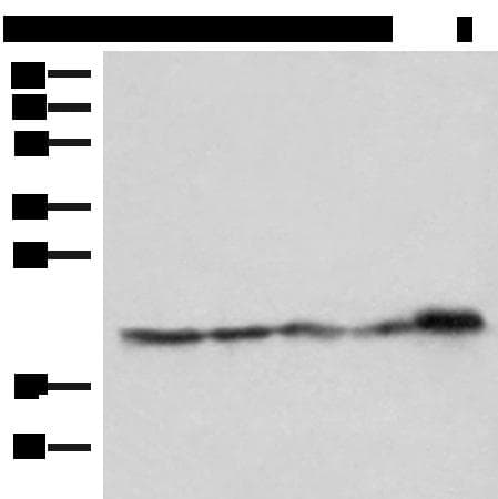 Polyclonal Rabbit anti-Human ATP5H Antibody (IHC, WB)