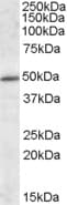 IHC-plus™ Polyclonal Goat anti-Human IFT57 / HIPPI Antibody (aa103-117, IHC, WB)