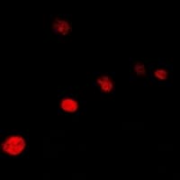 Polyclonal Rabbit anti-Human GTF2H3 Antibody (IF, WB)