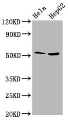 THNSL2 Antibody