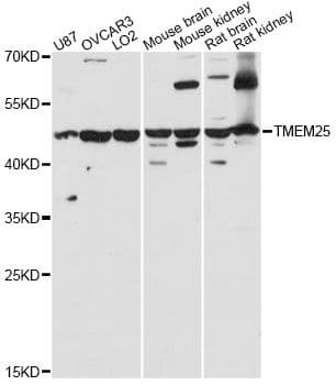 TMEM25 Antibody