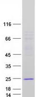 Human THYN1 / HSPC144 Protein (Recombinant Myc-DDK (Flag))