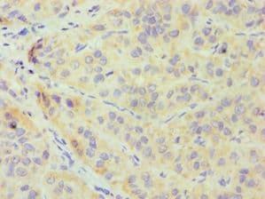 Polyclonal Rabbit anti-Human CRY1 Antibody (aa507-586, IHC)