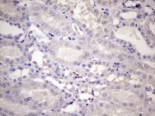 CDKN1A / WAF1 / p21 Antibody (aa2-164, clone OTI4B11)