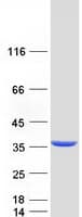 Human DECR1 Protein (Recombinant Myc-DDK (Flag))