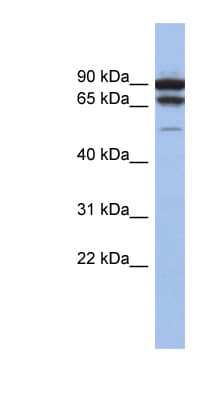 Polyclonal Rabbit anti-Human TP73 / p73 Antibody (C-Terminus, WB)