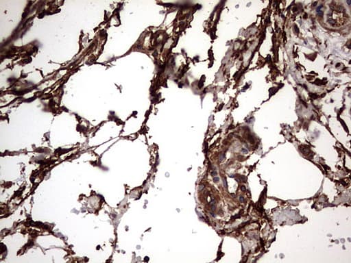 KRT7 / CK7 / Cytokeratin 7 Antibody (clone OTI2A2)