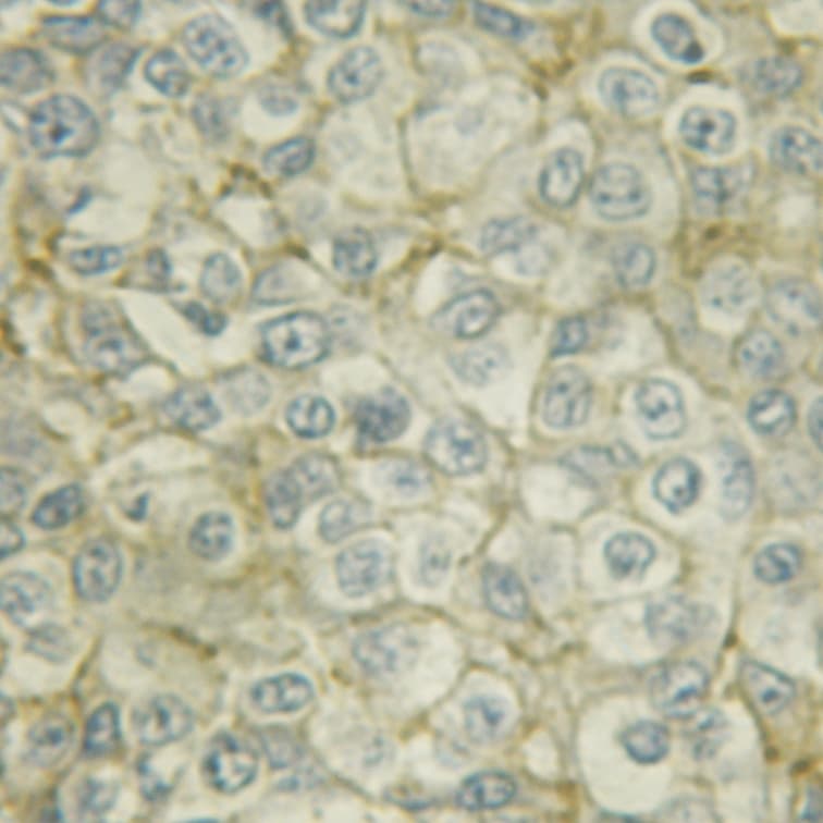 SYN / FYN Antibody (phospho-Tyr530)