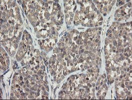 APP / Beta Amyloid Precursor Antibody (clone OTI4C9)