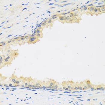 LIF Antibody