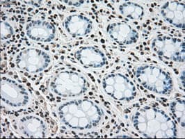 MAP2K4 / MKK4 Antibody (clone OTI4B4)