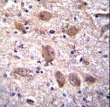 Paraplegin / SPG7 Antibody (aa115-141)