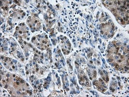 HDAC10 Antibody (clone OTI6G5)