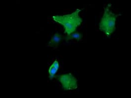 MAP2K1 / MKK1 / MEK1 Antibody (clone OTI5A11)