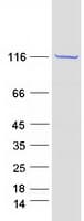 Human PC / Pyruvate Carboxylase Protein (Recombinant Myc-DDK (Flag))