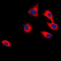 Polyclonal Rabbit anti-Human CADM2 Antibody (Internal, IHC, IF, WB)