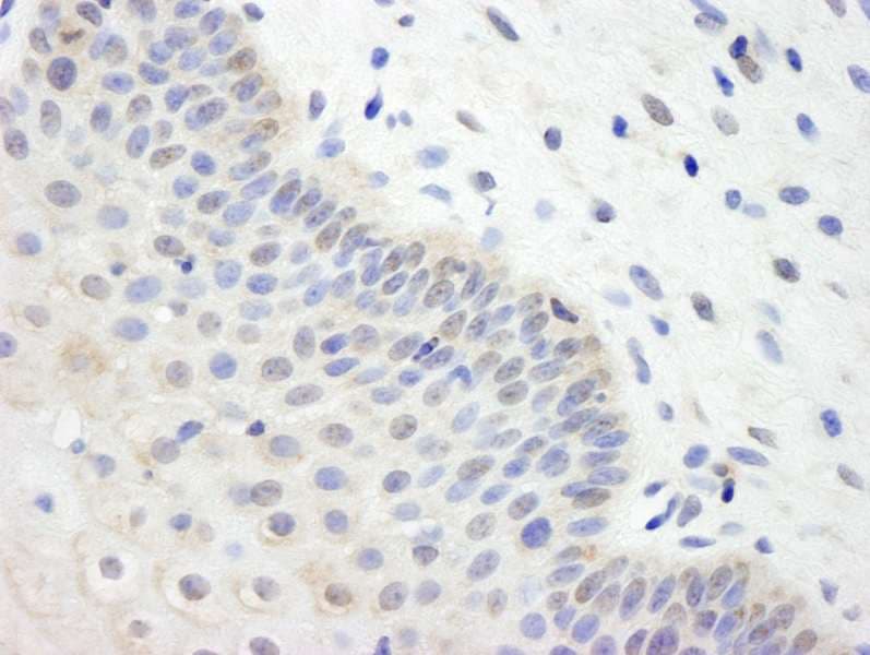 UBE2L3 / UBCH7 Antibody (aa100-C-term)
