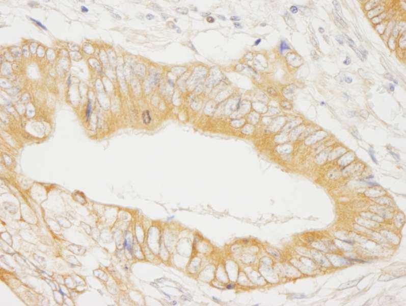 MAP4K4 Antibody (aa550-600)