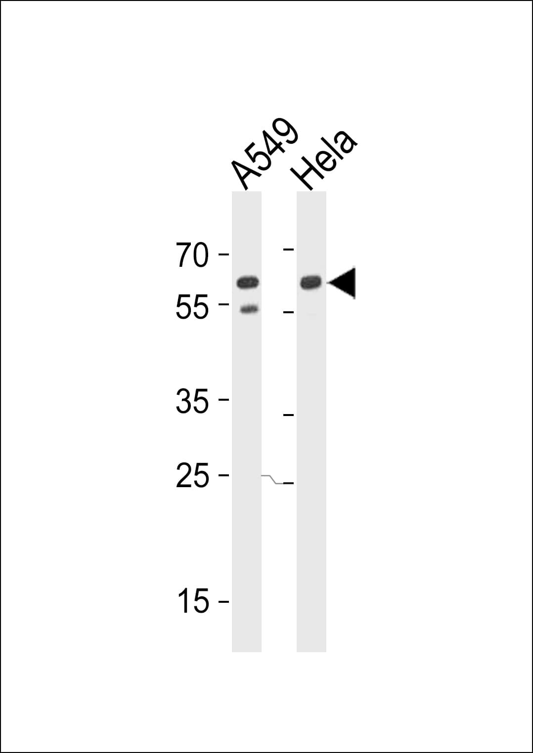 Polyclonal Rabbit anti-Human CD46 Antibody (aa330-361, WB)