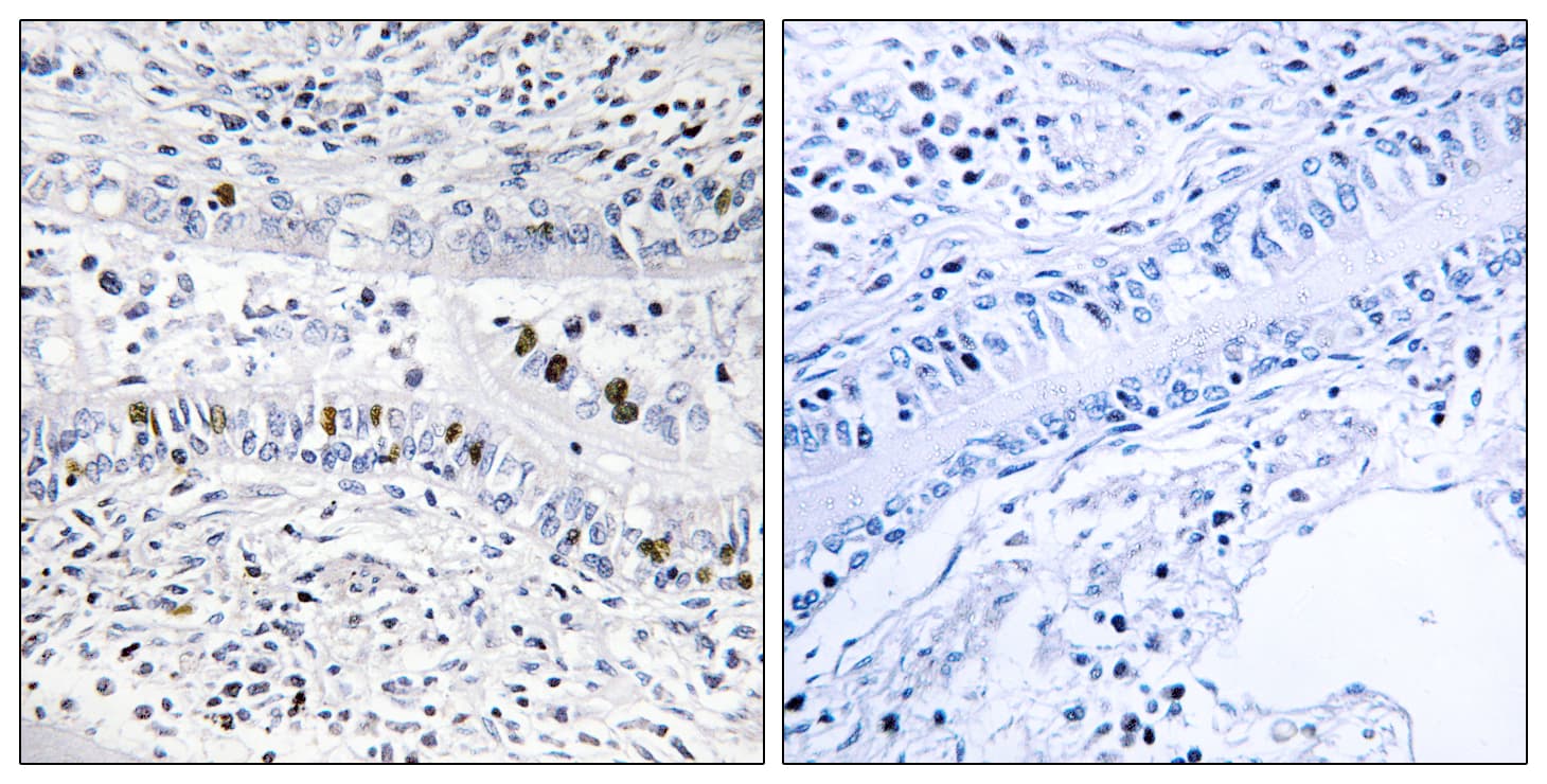 Polyclonal Rabbit anti-Human EZH1 / ENX-2 Antibody (aa171-220, IHC, WB)