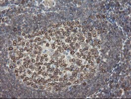 Monoclonal Mouse anti-Human UBE2J1 Antibody (clone OTI3C11, IHC, WB)