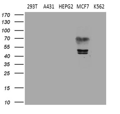 ESRRA / ERR Alpha Antibody (aa206-417, clone OTI3G3)