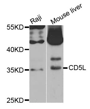 Polyclonal Rabbit anti-Human AIM / CD5L Antibody (IHC, WB)