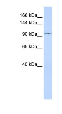 TRPC6 Antibody (aa792-841)