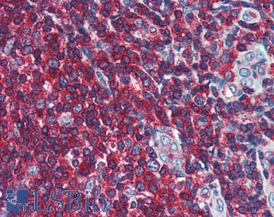 IHC-plus™ ARPC1B / p41-ARC / ARP2 Antibody (aa322-372)