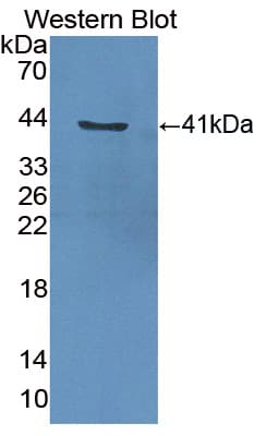 ADAP2 / CENTA2 Antibody (aa49-361)