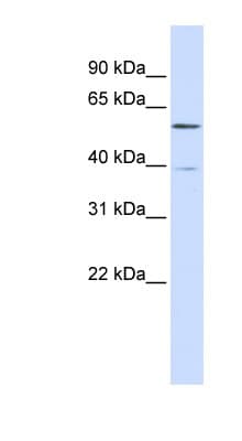 ZNF419 Antibody (N-Terminus)