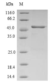 Human RFC1 / RFC Protein (Recombinant 10His, N-terminus + Myc, C-terminus)
