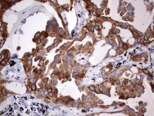 Acidic Cytokeratin Antibody (clone 5F9)