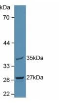 MTUS1 Antibody (aa1018-1270, PE)