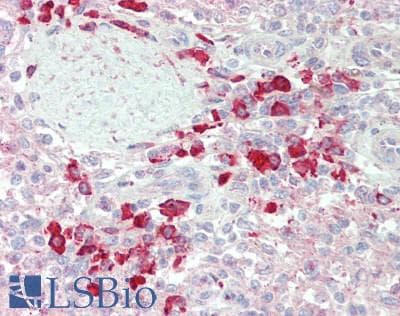IHC-plus™ Polyclonal Rabbit anti-Human HM13 / IMP-1 / SPP Antibody (IHC, WB)