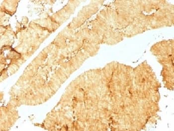 VIL1 / Villin Antibody (clone VIL1/1325)